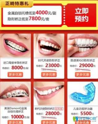 南京补牙牙套的价格表（南京做牙套多少钱一颗）