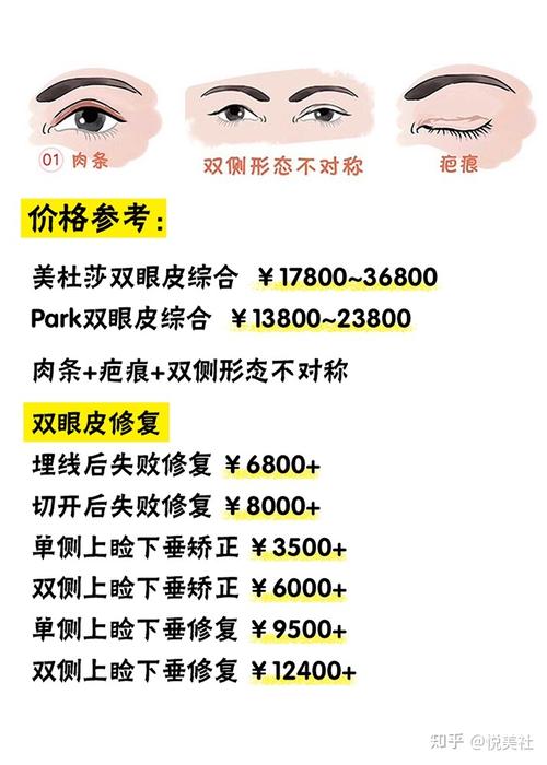 枣庄韩式双眼皮医院价格表（枣庄双眼皮手术）