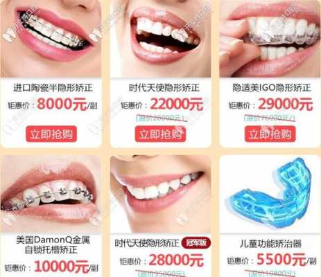 广州成人正畸牙齿价格（广州做牙齿矫正）