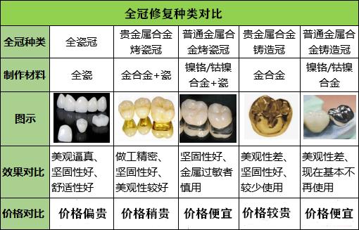 南京烤瓷牙套的价格（南京牙冠套多少钱）